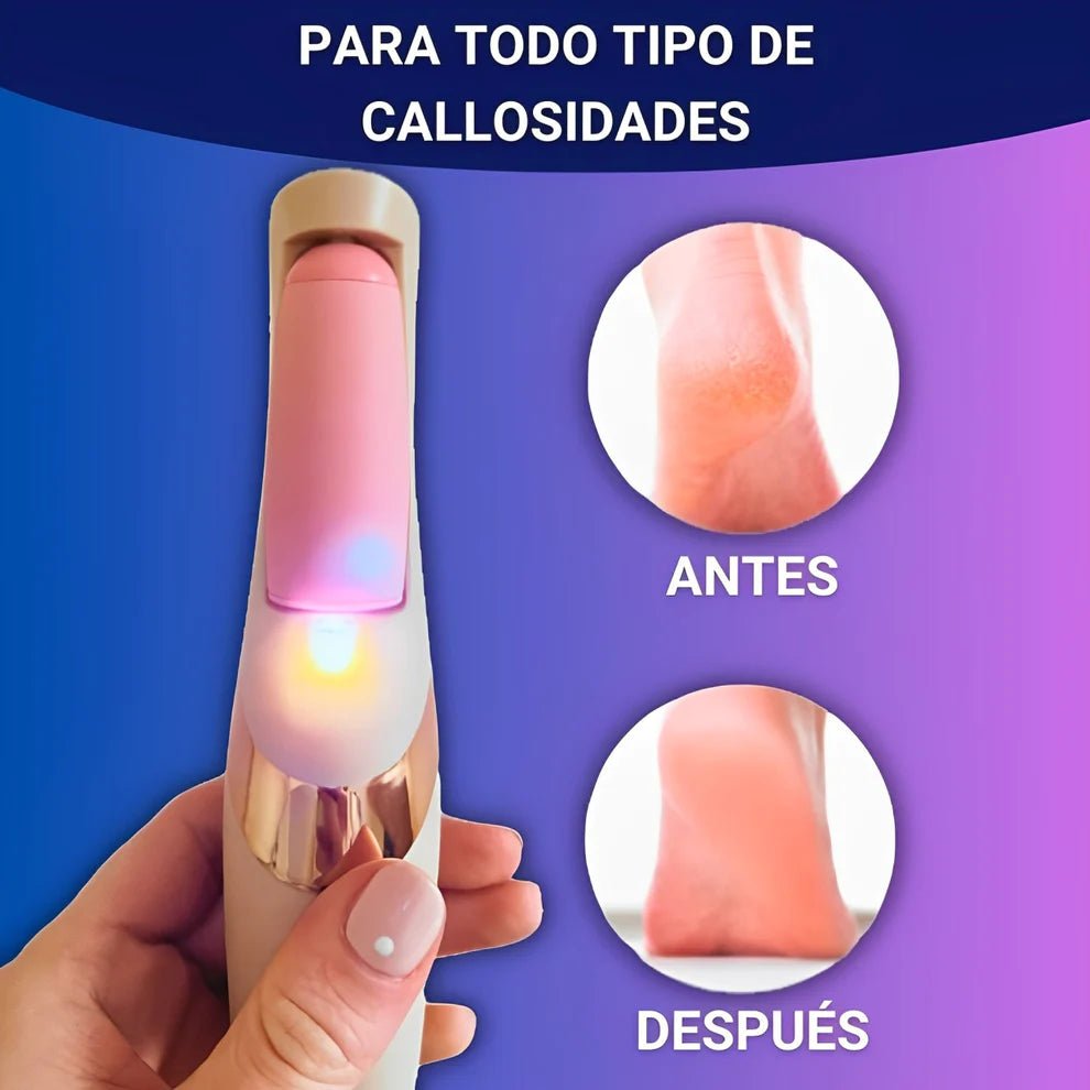 #proPODOLOGY® - Kit para eliminar durezas, callos y mantener tus pies bonitos y sanosduct_name# - TeknoVida